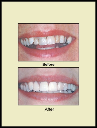 Before & After Prosthodontics Reference 2