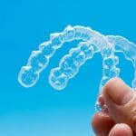 Can You Switch from Braces to Invisalign?