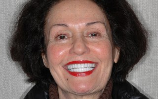 Mary's smile with straight, white teeth after dental treatment