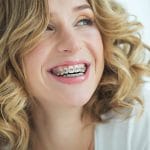 5 Reasons Getting Braces as an Adult Can Make You Happier