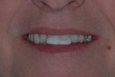Close Up Before Treatment