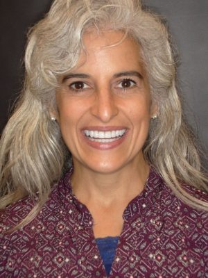 Woman-smiling-with-teeth
