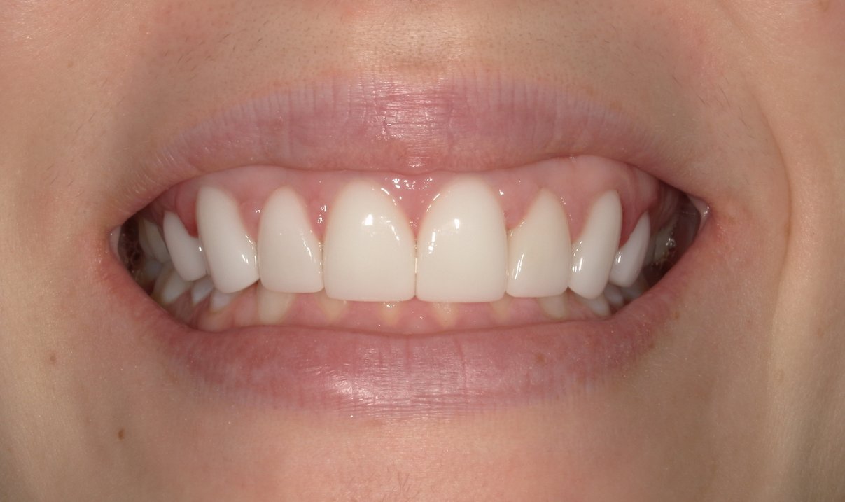Coordinating Special Care For A Beautiful Smile