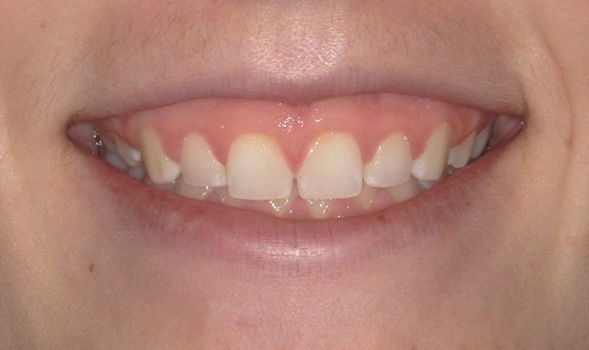 Coordinating Special Care For A Beautiful Smile